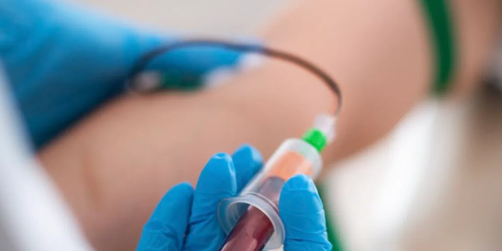 prp-blood-withdrawal