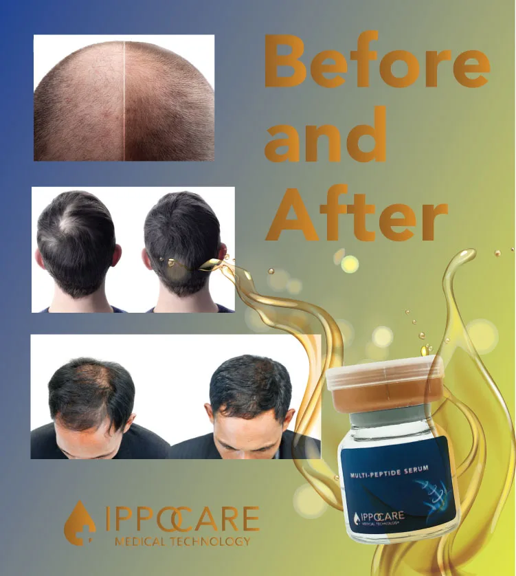 ippocare-hair-biotinoyl-result