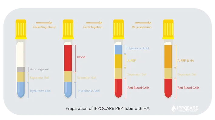 PRP-tube+HA-details-preparing-ippocare