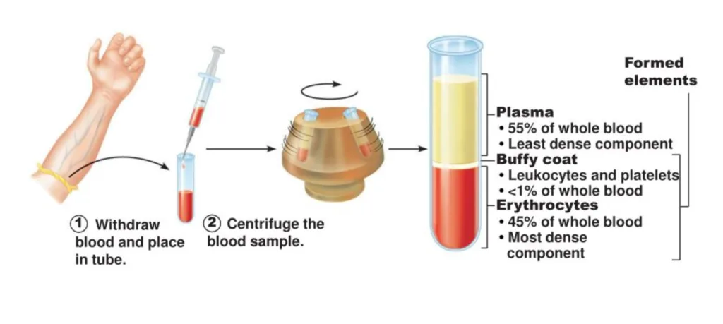 prp-treatment-procedure-ippocare