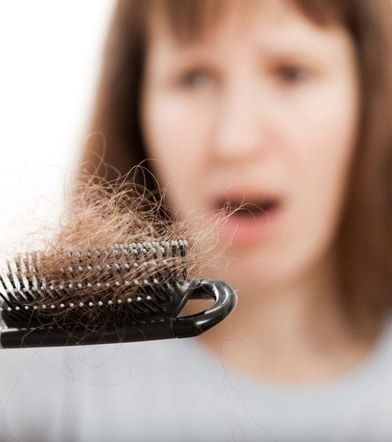 hair-loss-prp-help