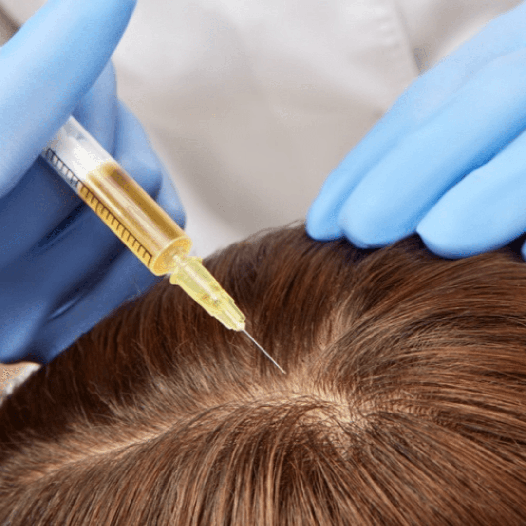 superficial-injections-hair-ippocare