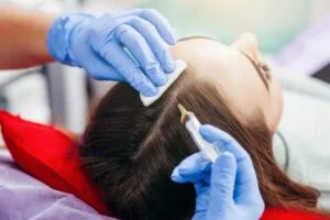 female-patient-receives-prp-hair-ippocare