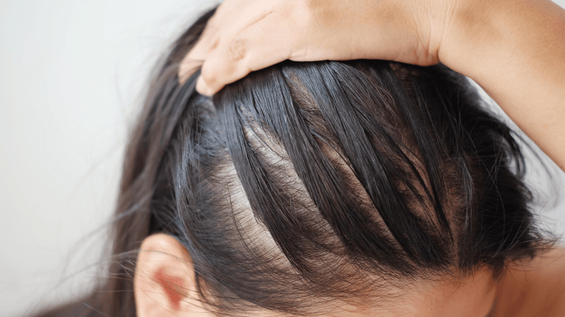 ippocare-Thinning hair with germinal peptide