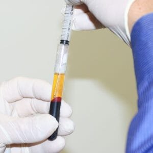 PRP-Therapy-Injections-ippocare