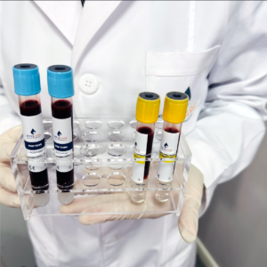 ippocare-prp-tubes-doctor
