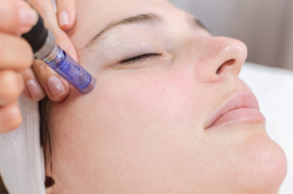 microneedling+HA_ippocare