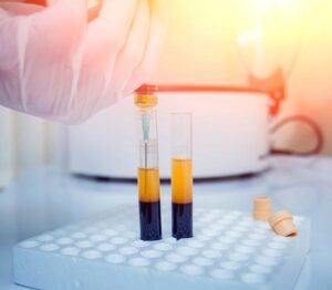 PRP Injection: Complete Guide for Clinics (Procedure & Benefits)