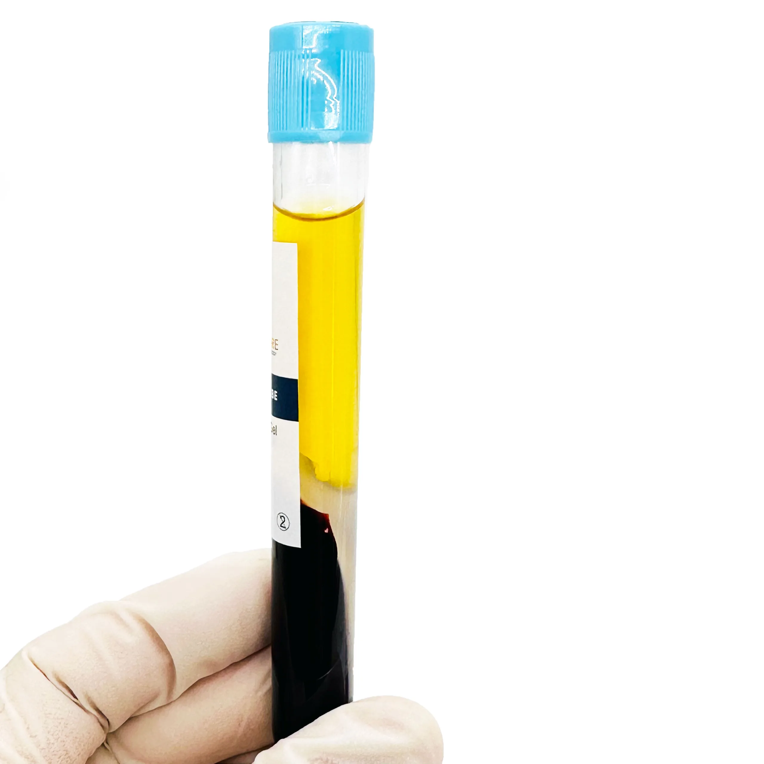 prp-tube-after-ippocare