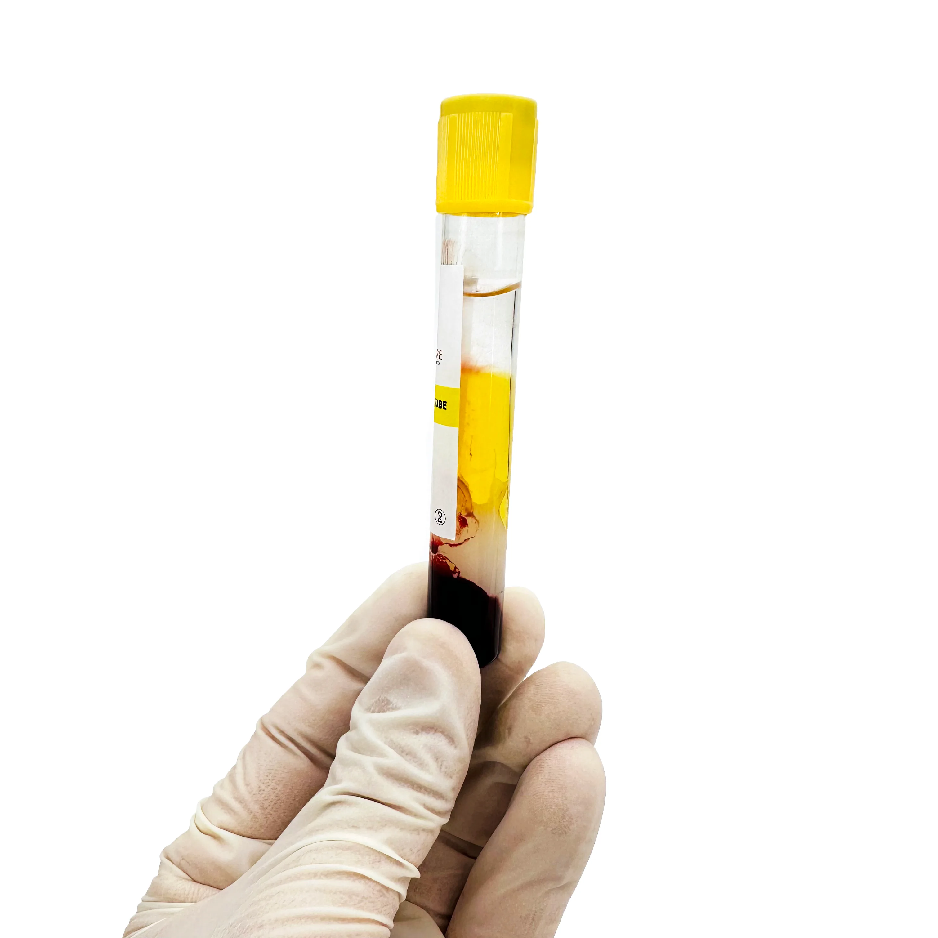 prp tube with HA_ippocare_how to use