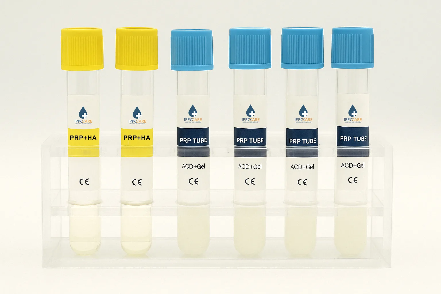 prp tube collections ippocare