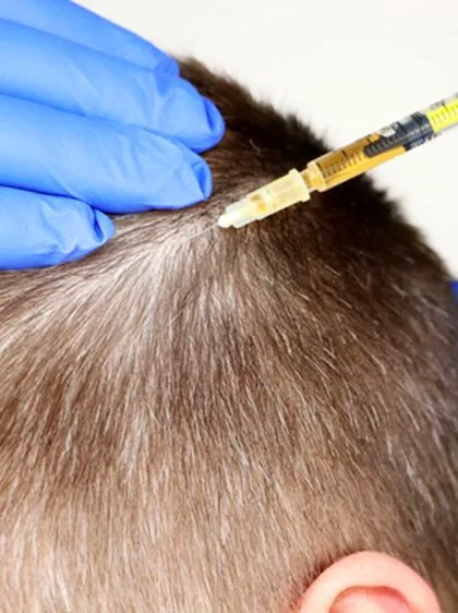 ay-treatment-hair-prp-pl322eb1l0ohwjoshsbotails8nj35msce8dzhi1v8