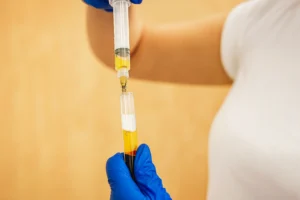 prp-tube-ippocare