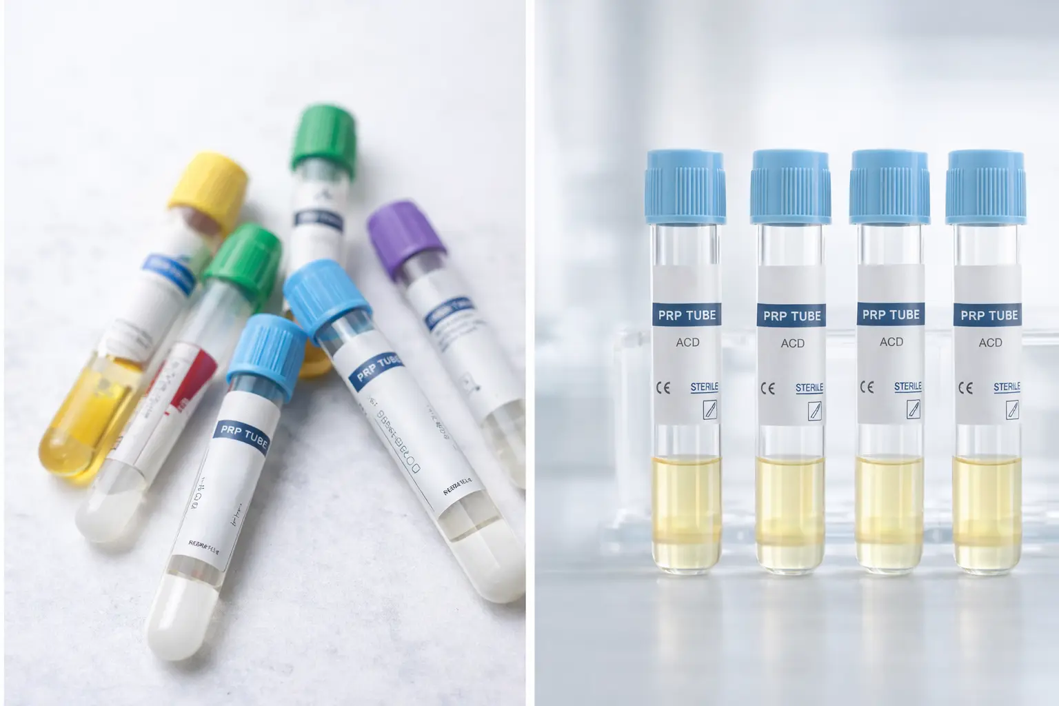 inconsistency-standardization