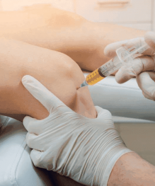 prp treatment knee