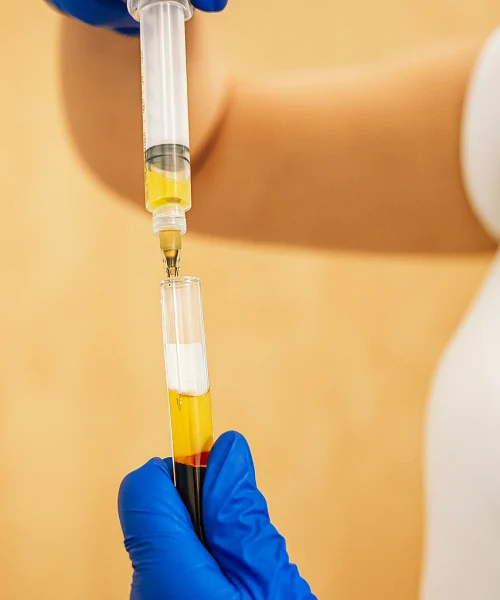 prp-tube-ippocare