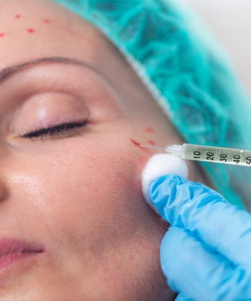 Aesthetic PRP-IPPOCARE