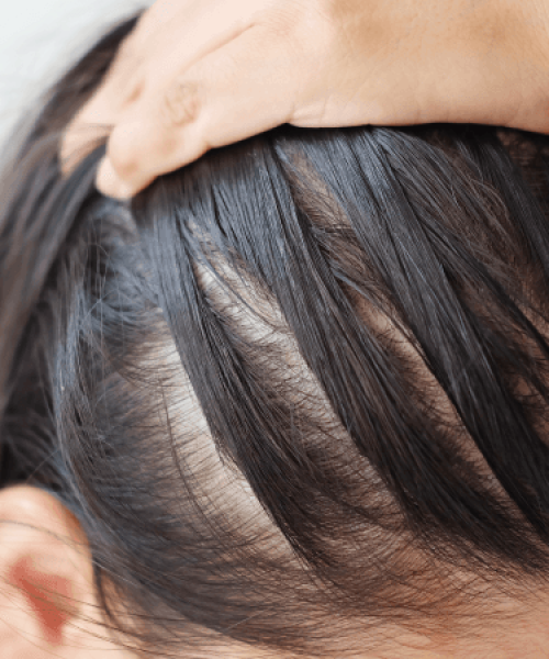 ippocare-Thinning hair with germinal peptide