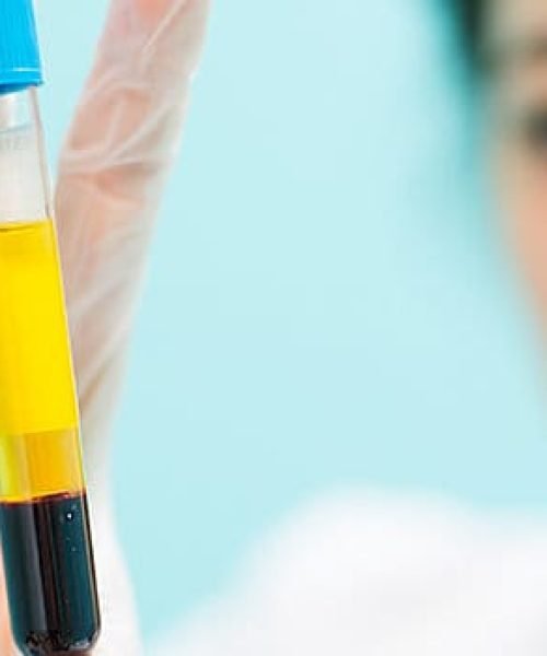 platelet-rich-plasma-popular-ippocare