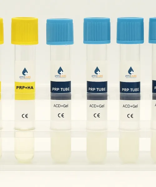 prp tube collections ippocare